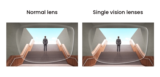 vision loss normal lens normal retina